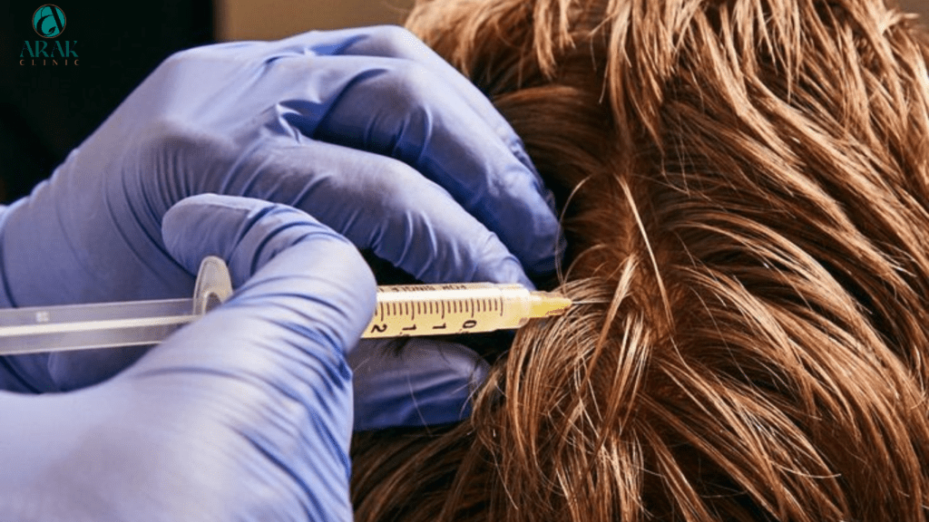 From Platelet Rich Plasma To Microneedling Revolutionary Hair